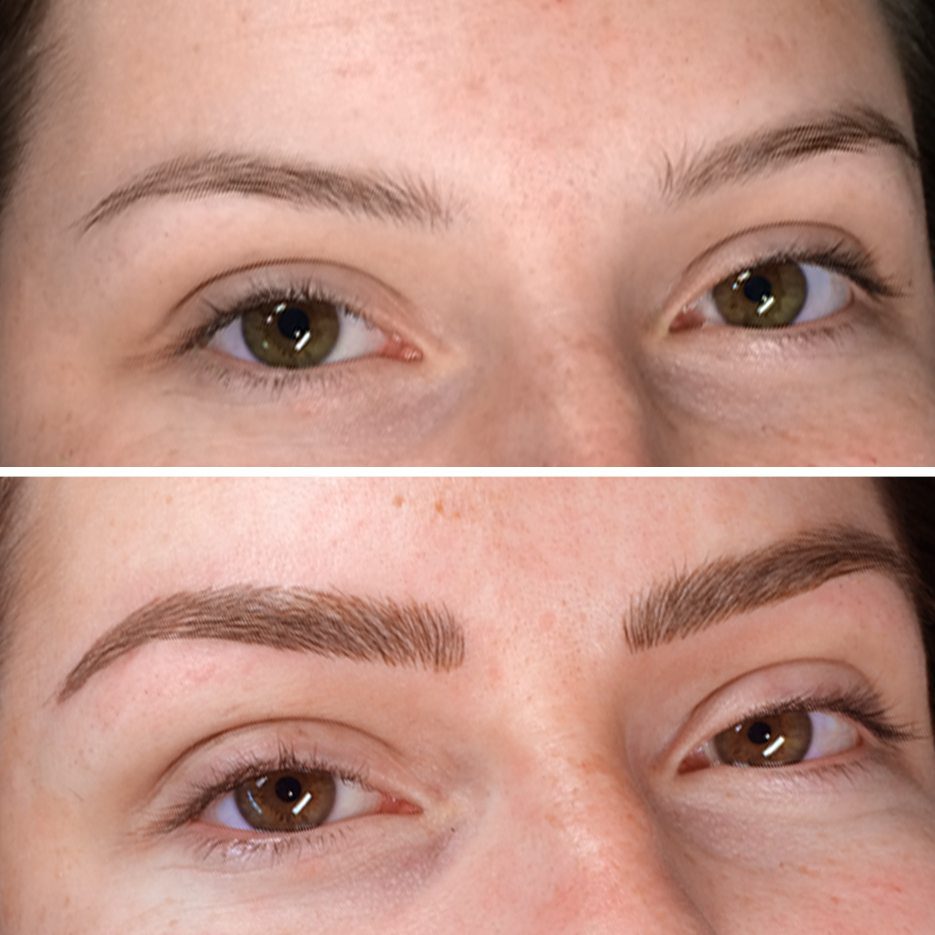 Eyebrow Tattoos: The Best Cosmetic Treatment For A More Youthful Appearance  - La Klinic